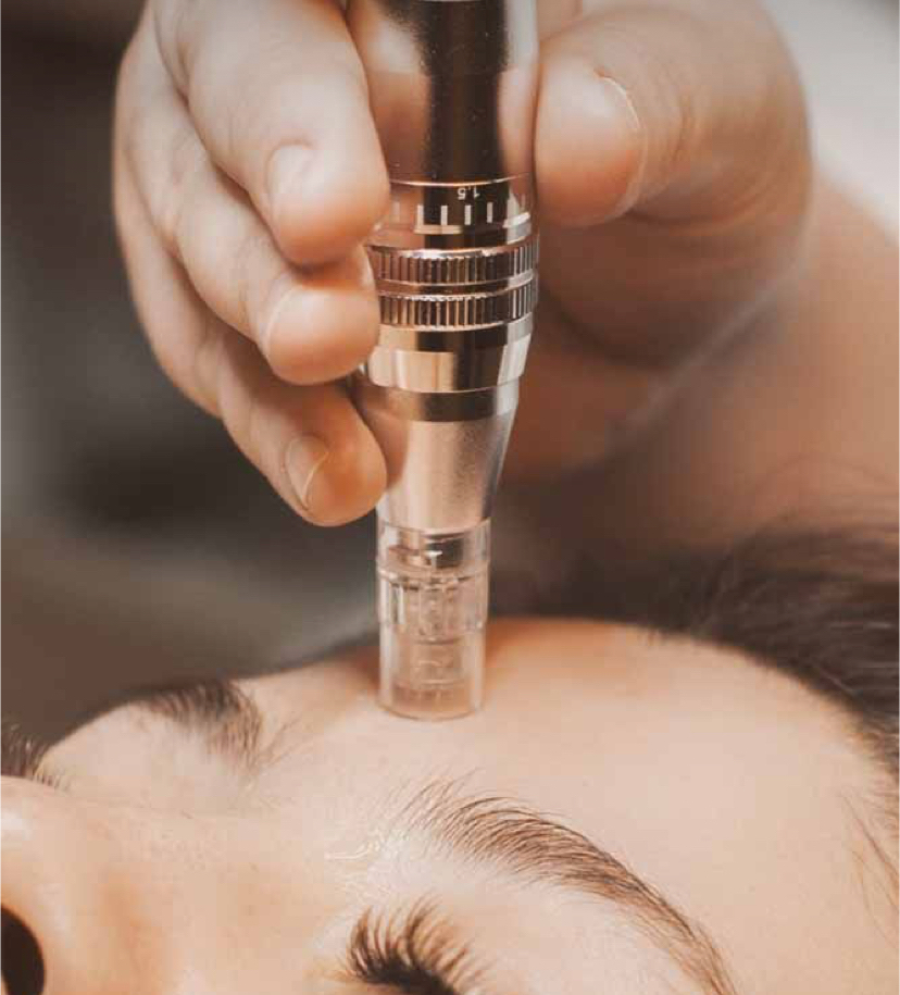 Microneedling Facial