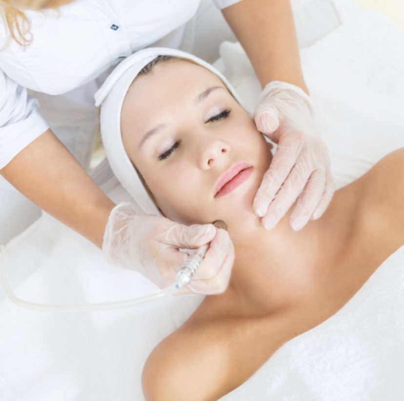 Microdermabrasion - 60 Mins