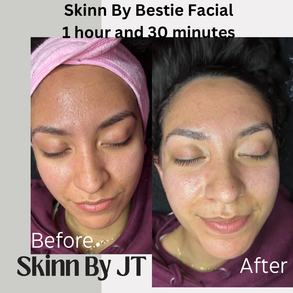 Skinn By Bestie Facial