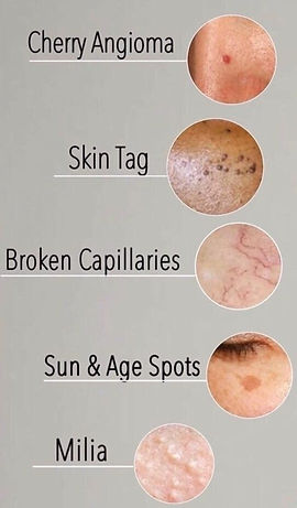 Skin Classic Treatment