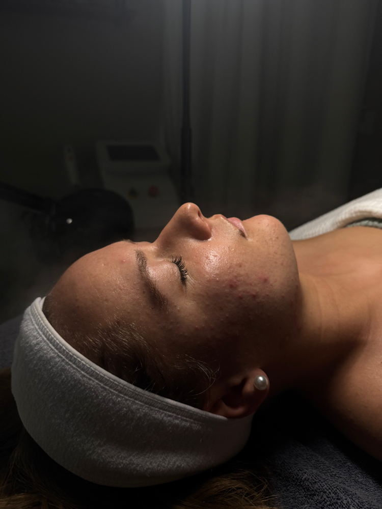 Consultation at MadSkin Esthetics in Colorado Springs, CO