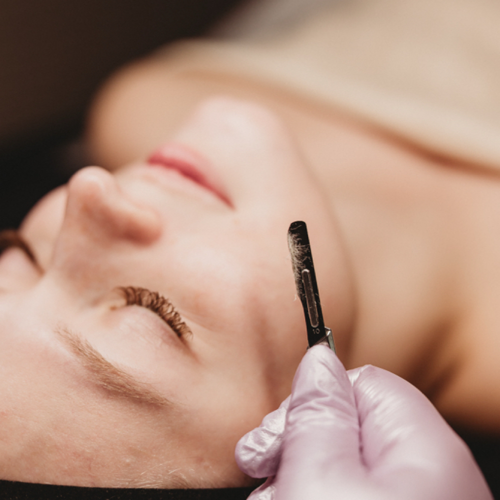 Dermaplane at Aurora Beauty in Normal, IL