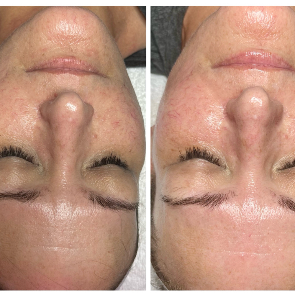 Current Special 🌸 at Sigh Beauty Bar in Merritt Island, FL