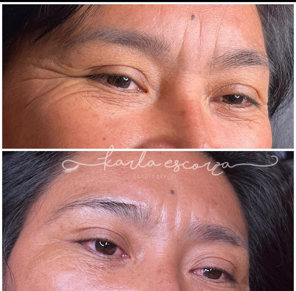 Fibroblast Eyes at LASHES AND BROWS By Karla Escorza in Northglenn, CO