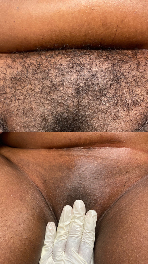 Brazillian Wax
