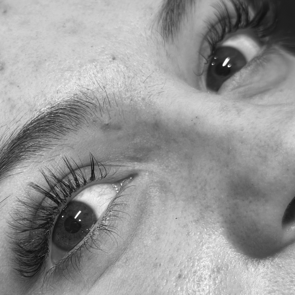 Hybrid Fill at Kolbi Fougerousse Esthetics in Dugger, IN