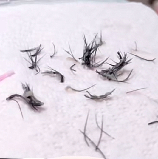 Lash Removal