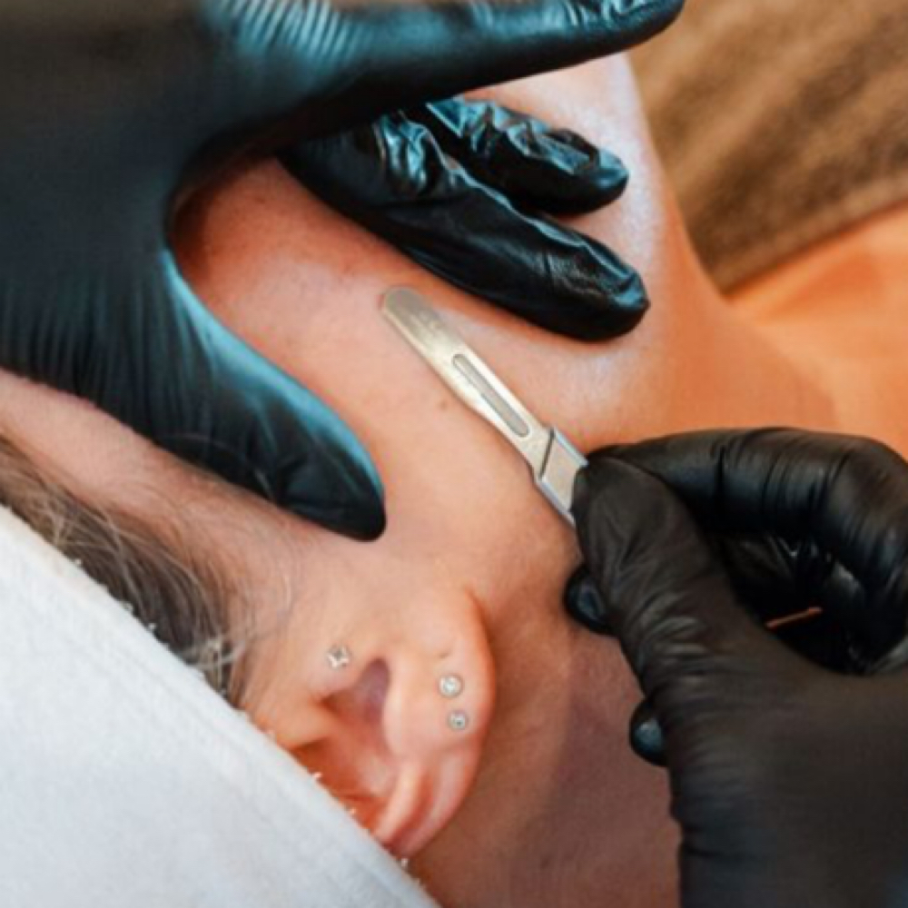 Dermplaning Facial at Lyza Luxe Skin in Fort Myers, FL