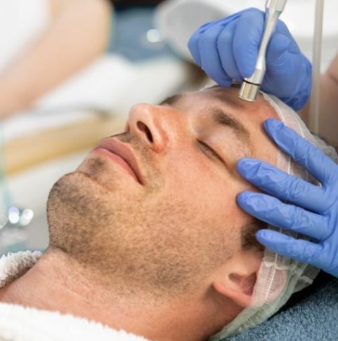 Dermabrasion (Diamond or Hydro)