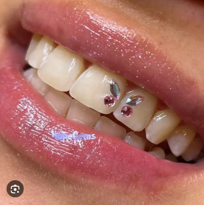 Butterfly Tooth Gem