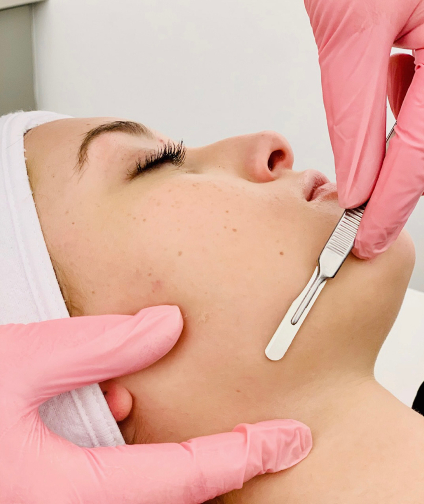 Dermaplane Facial