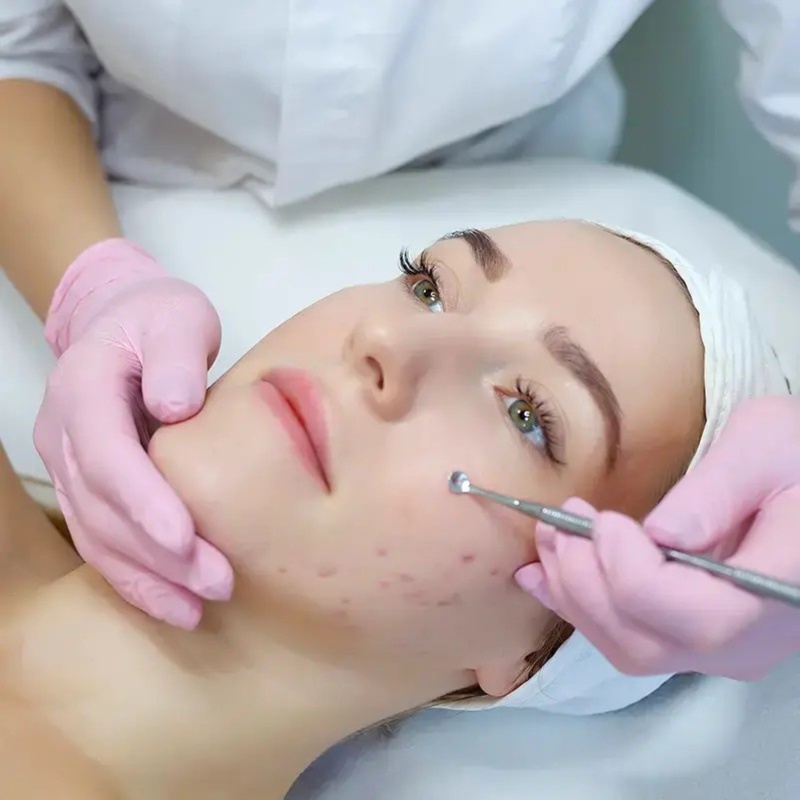 Acne Relief Facial at Worthy of Wellness LLC in Winter Park, FL