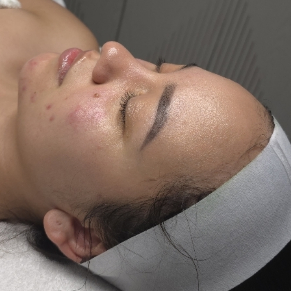 A1 Oxygen Facial at Stephs A1 Beauty Bar in Southwest Ranches, FL