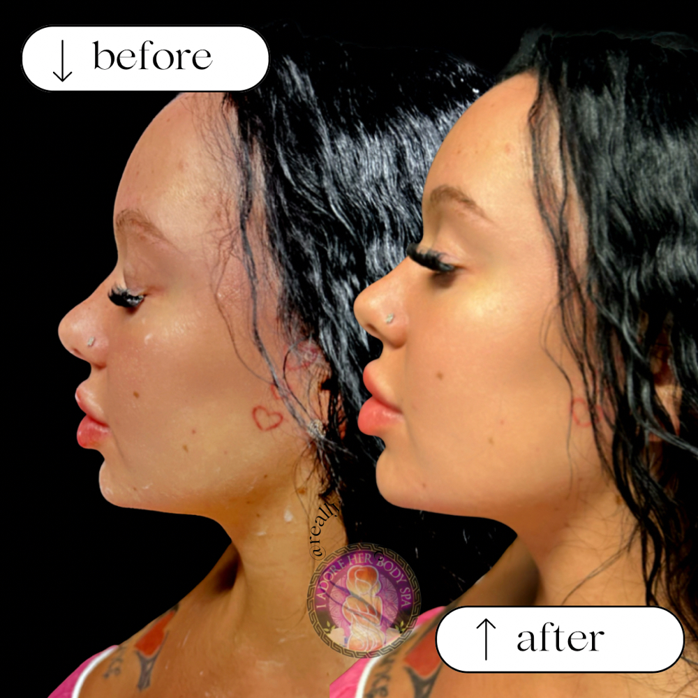 Facial Lymphatic Drainage