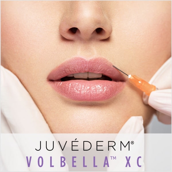 Juvederm Volbella