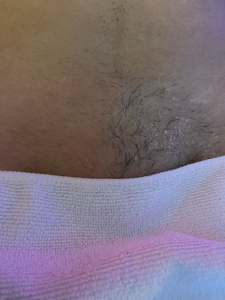 Brazilian Wax