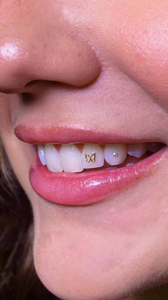 Tooth Gem Application