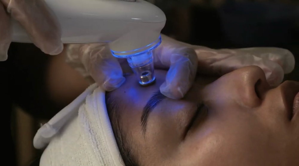 Blue Diamond Facial at AesthetiX in Austin, TX