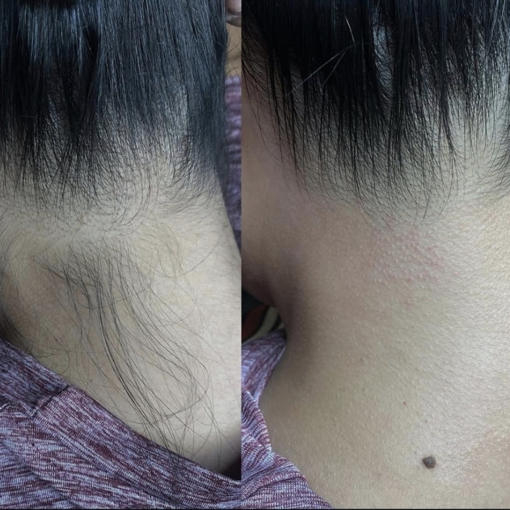 (Back) Neck Wax at TEXAFIED BEAUTY LLC in Lufkin, TX
