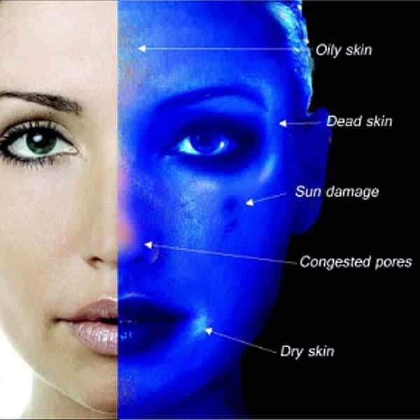 Consultation/ Skin Analysis