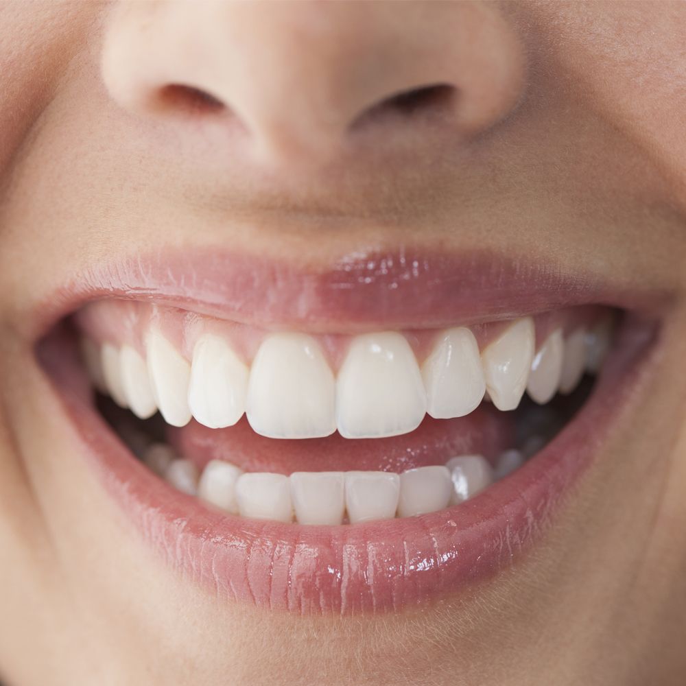 Express Teeth Whitening