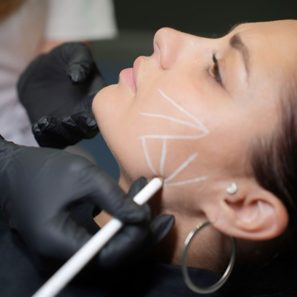 4-6 Month Tox Follow Up at Lilli Aesthetics LLC in Mansfield, TX