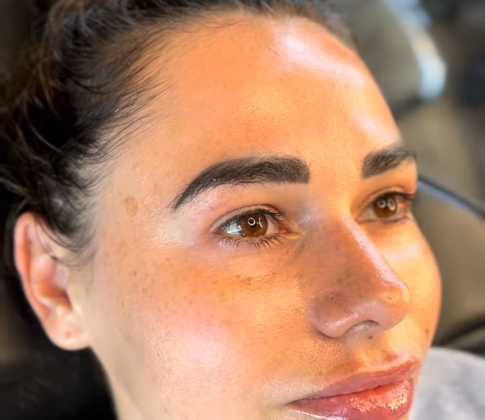 Glass Skin Treatment