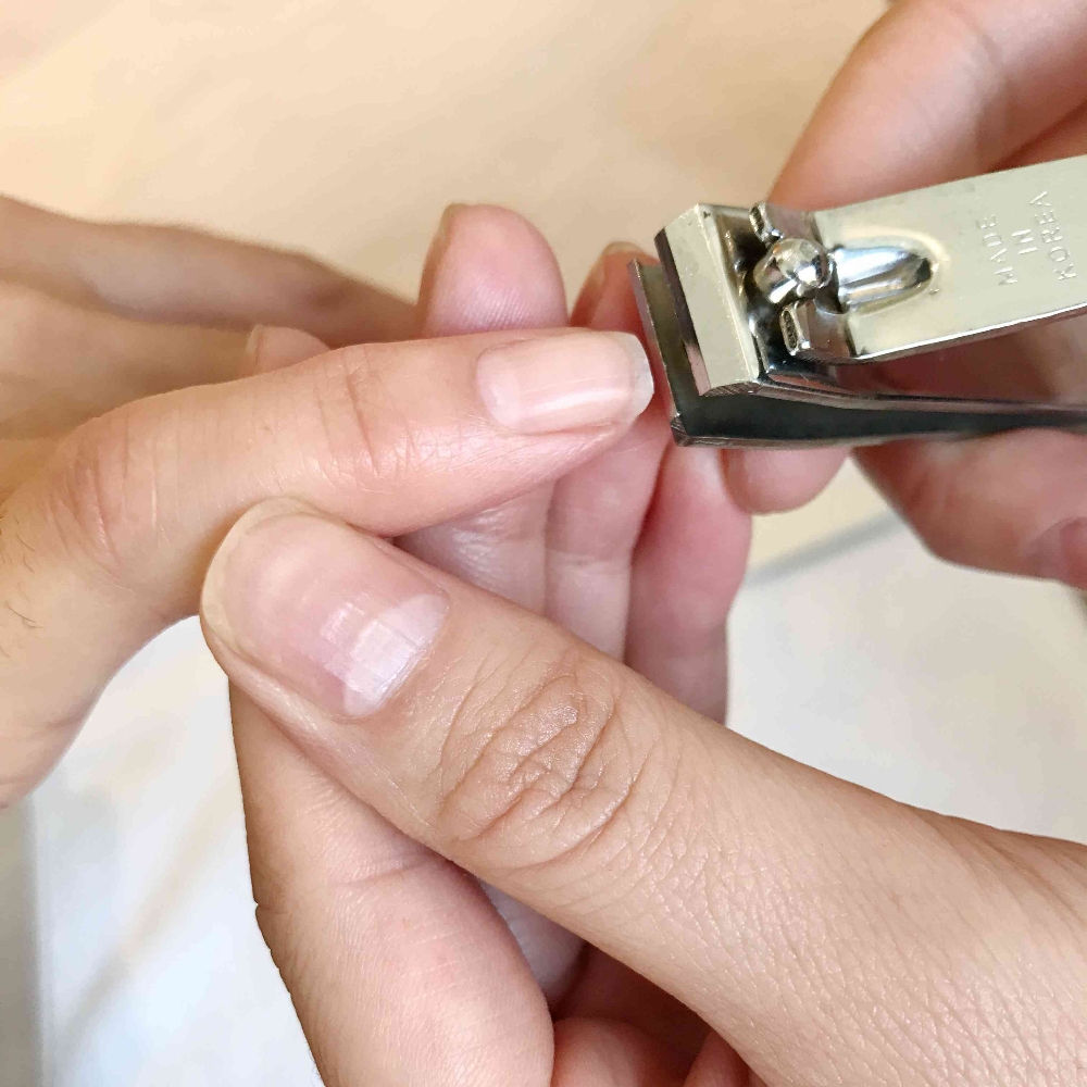 Finger Nail Trim