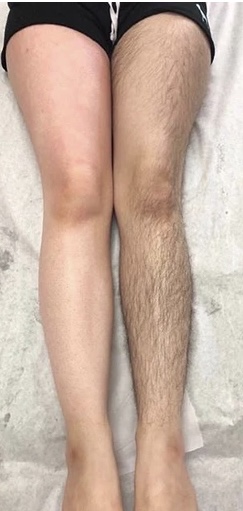 Full Leg
