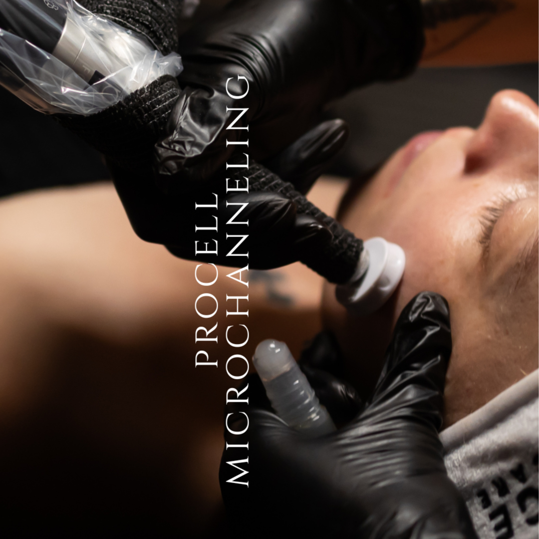 Procell Microchanneling MD at R&R Aesthetics - Prescott, Arizona in Prescott, AZ