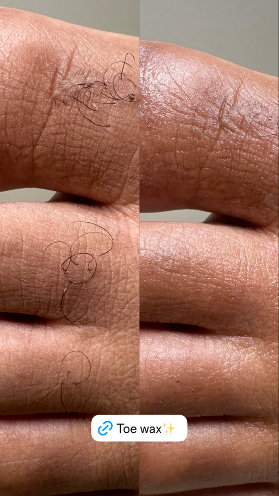 Toe Wax at J Esthetics in Homewood, IL