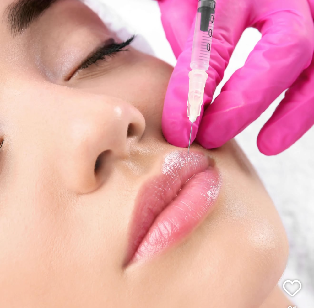 Lips 1/2 syringe at Glamorous Glowtox By Christina in Pasadena, TX