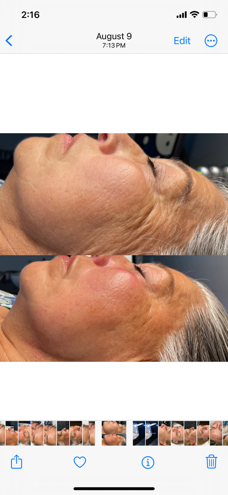 Platinum Hydrafacial (Face)