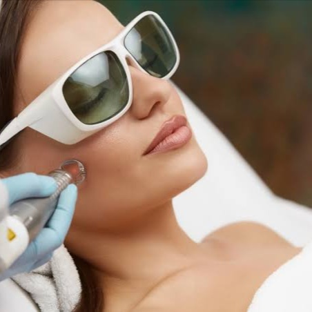 Fotona Laser at E.V. Aesthetics in Hawthorne, CA