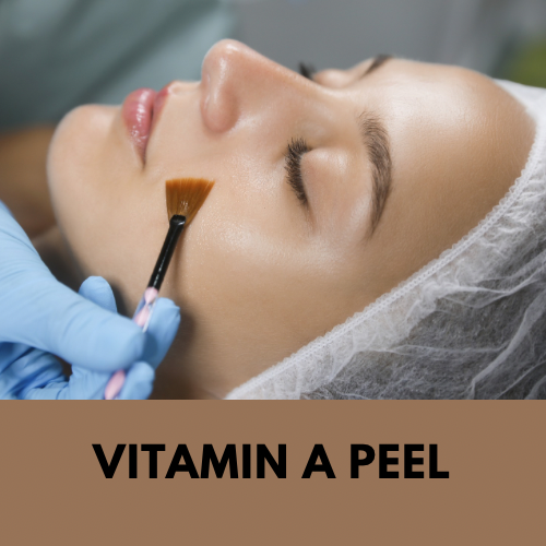 The Vitamin A Peel