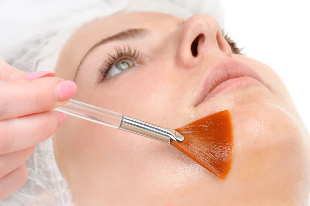CHEMICAL OR ENZYMATIC PEEL