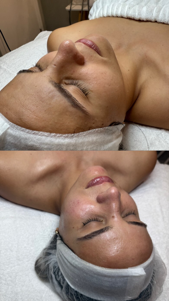 Limpeza De Pele Premiun at Jessica Luchesi Skin Wellness in Elizabeth, NJ