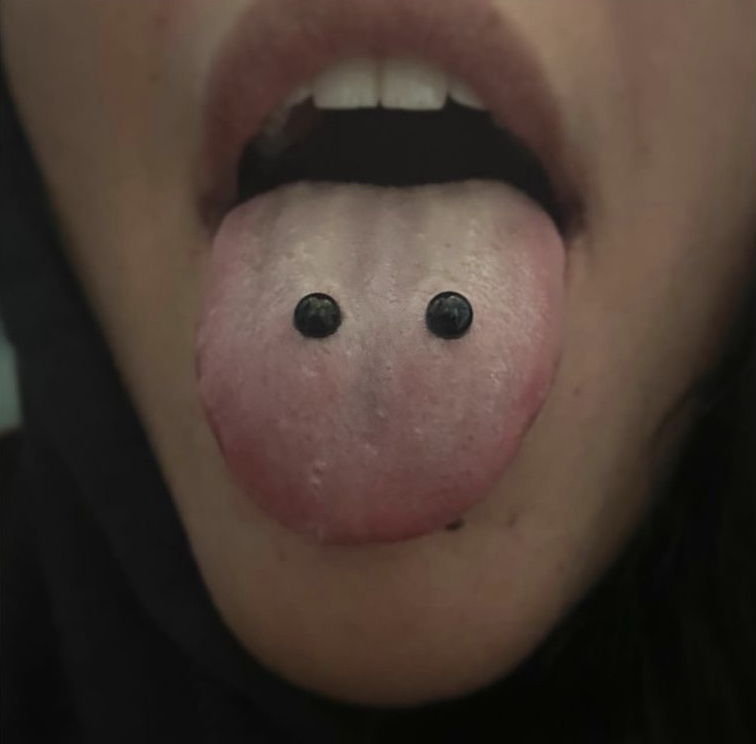 Tongue