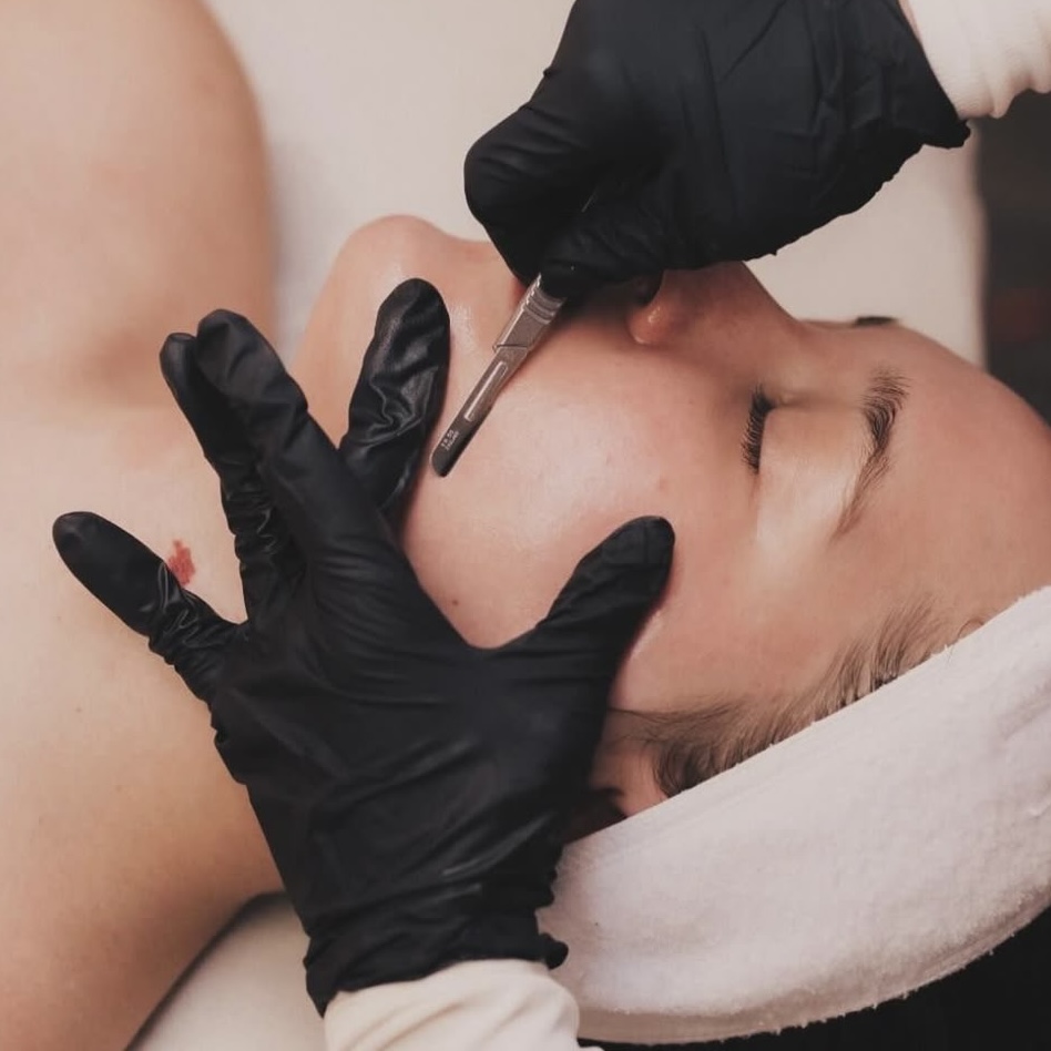 Dermaplane Facial at Inked Beauty By Marina in Gustine, CA