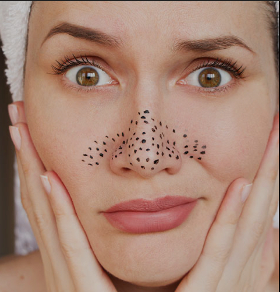 Blackhead Buster Facial