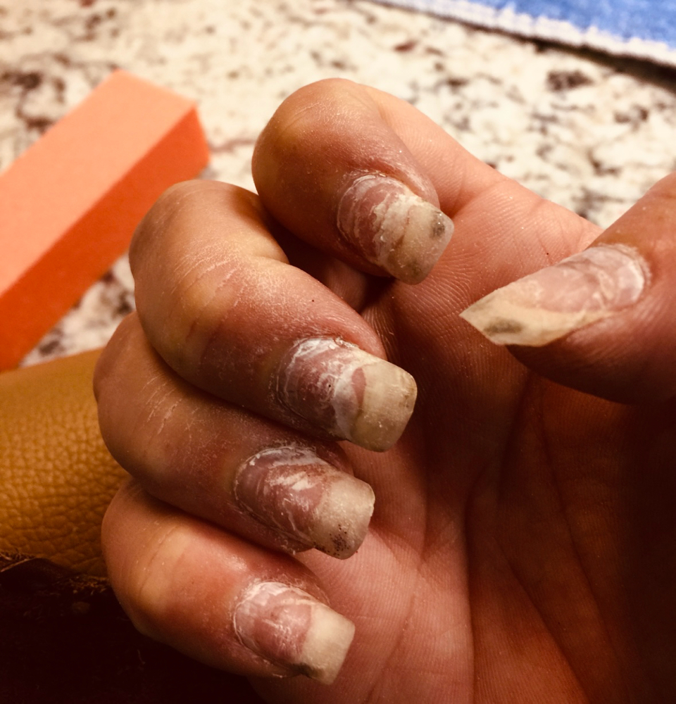 Removal Of Nail Extensions