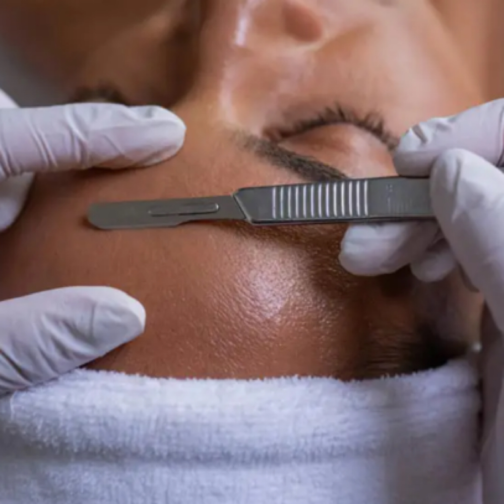 Dermaplane Facial