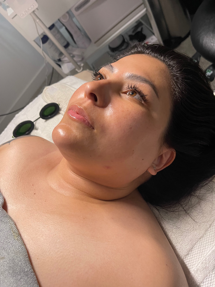 Dermaplane Deluxe Treatment