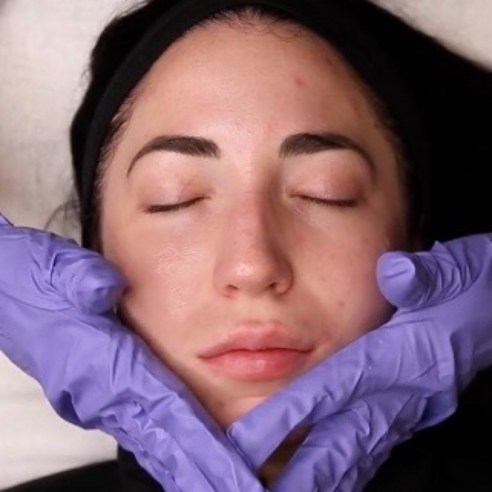 PCA Corrective Facial at Empowered Esthetic in Rancho Santa Margarita, CA