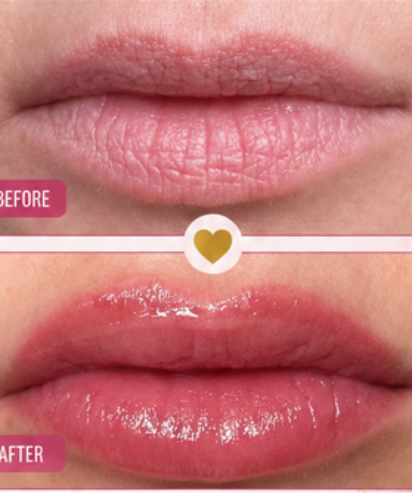 Lip Blushing at Chatuge Med Spa & Fitness in Hiawassee, GA
