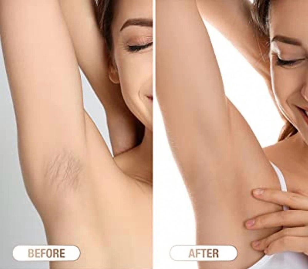 Underarm Waxing