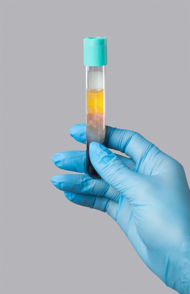 Dermapen Prp