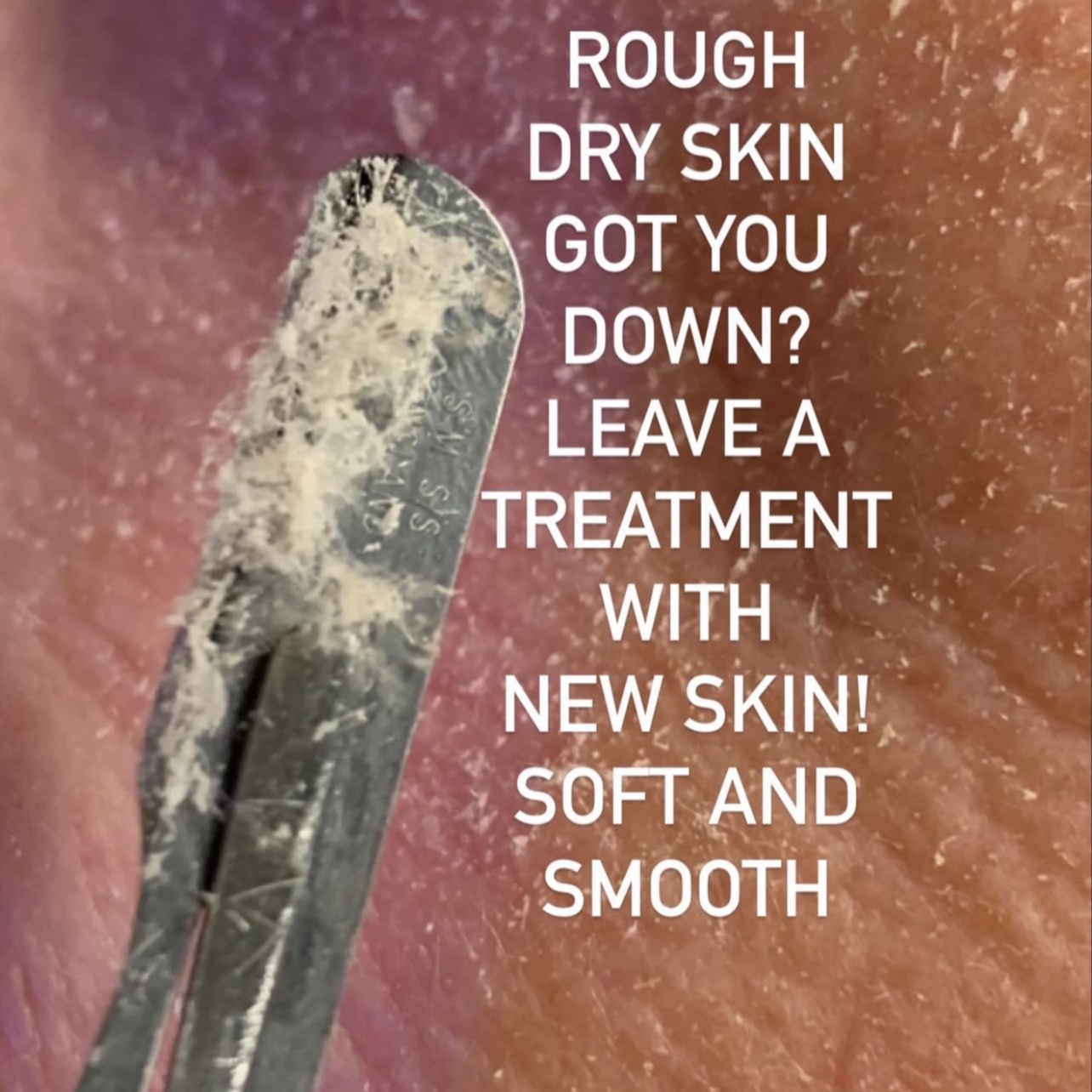 Relaxing Dermaplaning Facial at Plush Spa in Joplin, MO