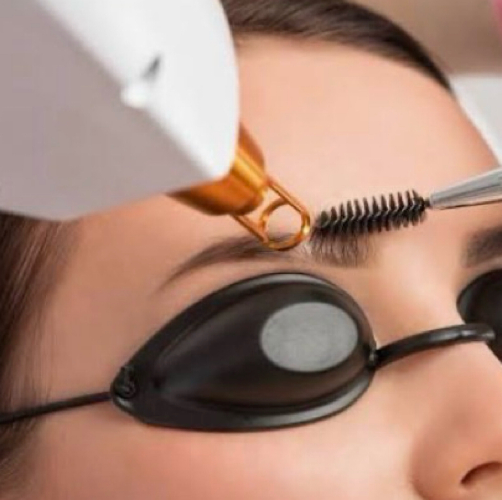 Laser Tattoo Removal - PMU at NICHÉ in Lewisville, TX