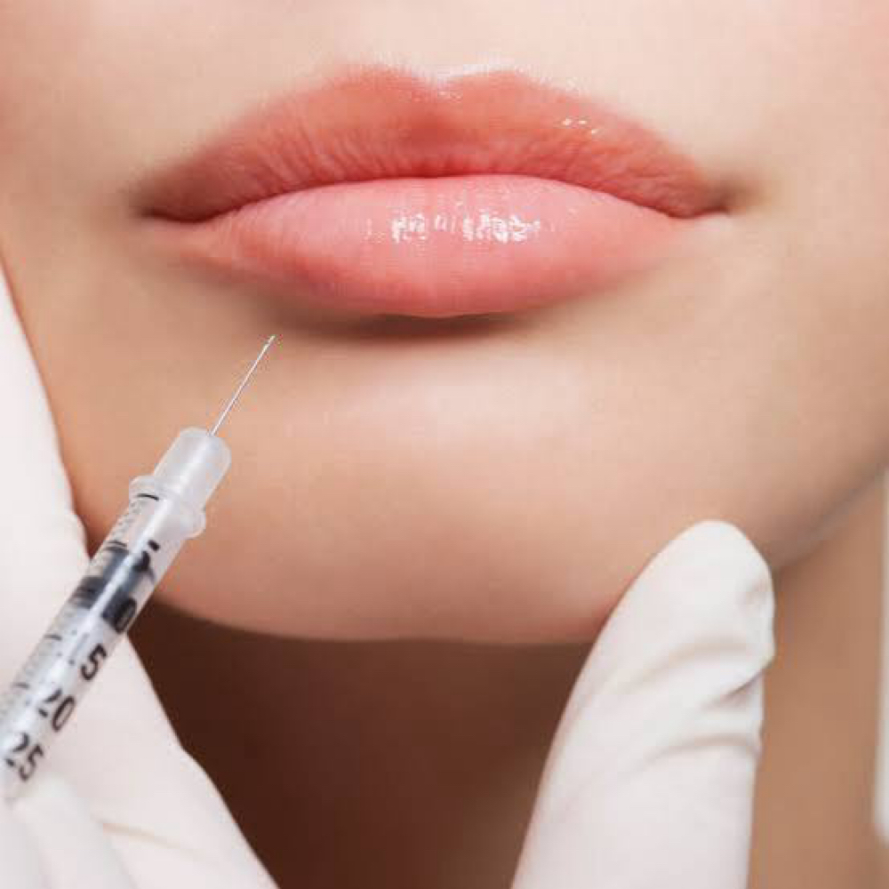 Lip Filler Injection at The Hope Edit in O'Fallon, MO